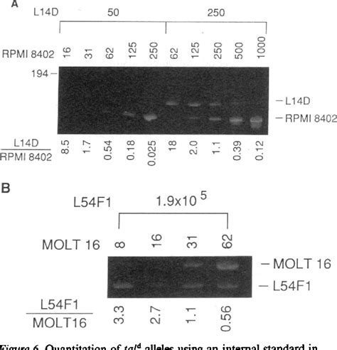 Figure From Rearrangements Of The Tal Locus As Clonal Markers For T