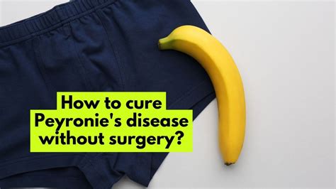 How to Cure Peyronie's Disease without Surgery?