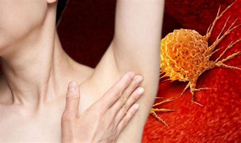 Cancer Symptoms Of Skin Cancer May Include Lumps Under The Armpit Uk