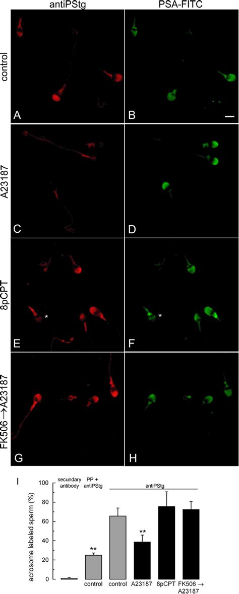 Synaptotagmin Dephosphorylation Depends On Calcium And Calcineurin