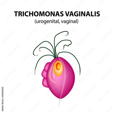 Vector Illustration Trichomonas Vaginalis Structure Trichomoniasis Hot Sex Picture