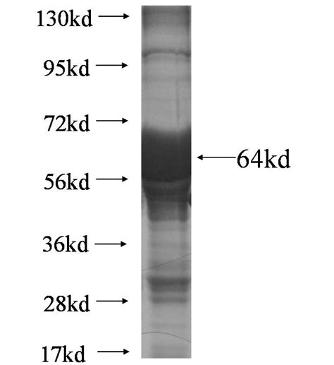 NBAS Fusion Protein Ag6407 Proteintech