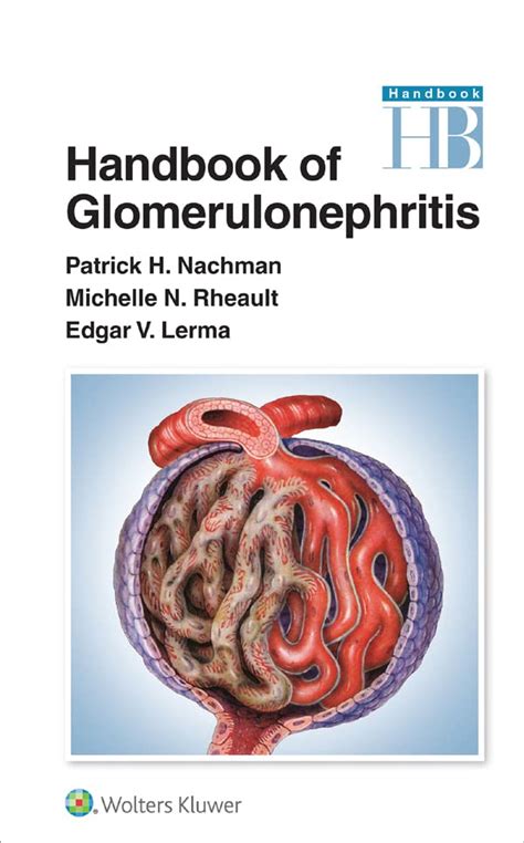 Handbook Of Glomerulonephritis English Edition Ebook Nachman