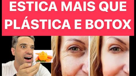 Use Nas Rugas Estica X Mais Que Botox Acaba Rugas E Manchas