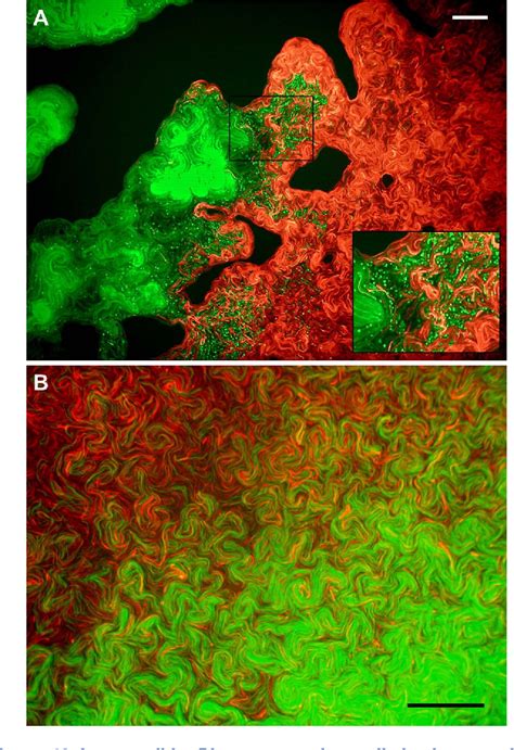 Pathogenesis Of Proteus Mirabilis Infection Semantic Scholar