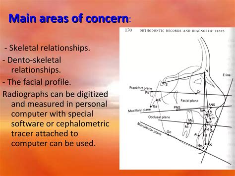 Extra Oral Radiology Techniques I Ppt