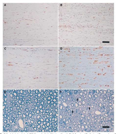 Figure 3 From The Role Of The Very Late Antigen 4 And Its Counterligand