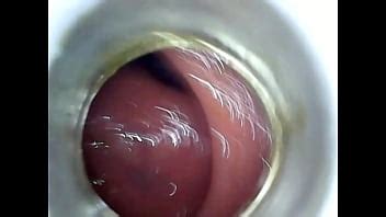 Speculum Videos XVIDEOS
