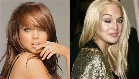 Top 10 Most Botched Celebrity Plastic Surgery Jobs Use Nerium To