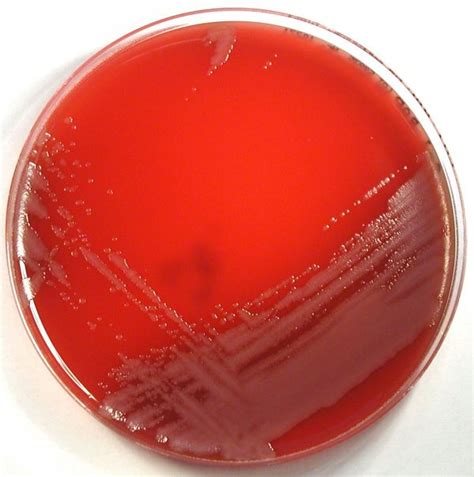 Acinetobacter | Medical Laboratories