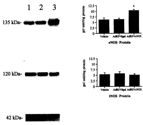 Left Western Blot Analysis Demonstrates Expression Of Enos 135 Kda Download Scientific