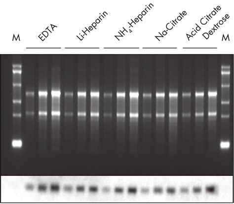 QIAamp RNA Blood Mini Kit | Blood RNA Extraction | QIAGEN