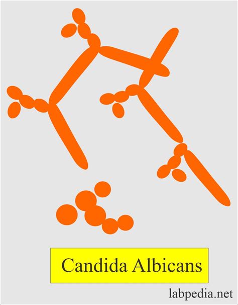 Candidiasis, Candida albicans and Diagnosis - Labpedia.net