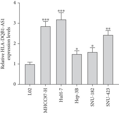 Hla Dqb As Is Upregulated In Hepatocellular Carcinoma A