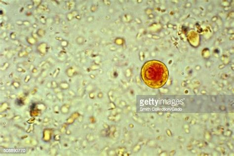 This Photomicrograph Depicts A Mononucleated Cyst Of An Entamoeba Photo Dactualité Getty