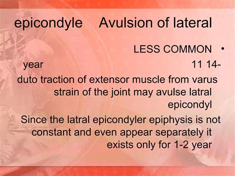 The elbow fracture | PPT | Free Download