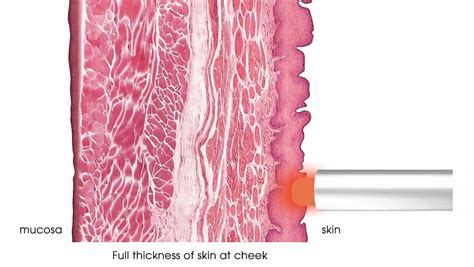 Fotona® 4d5d6d Pro Facelift Laser Treatment In Singapore