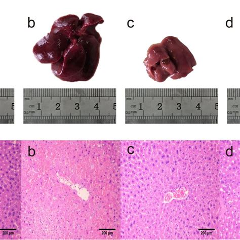 Effects Of DWYG On TAA Induced Histopathological Changes In Livers A