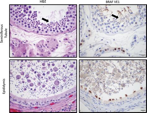 Immunohistochemistry Analysis Of Seminiferous Tubules And Epididymis