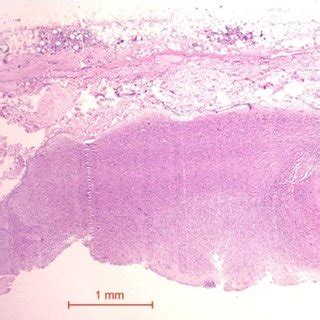 (PDF) Effect of Bio-Oss® Collagen and Collagen Matrix on Bone Formation~!2009-11-17~!2010-02-21 ...