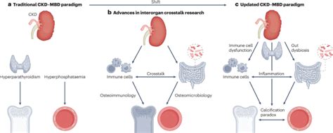 Inflammation And Gut Dysbiosis As Drivers Of Ckdmbd Nature Reviews