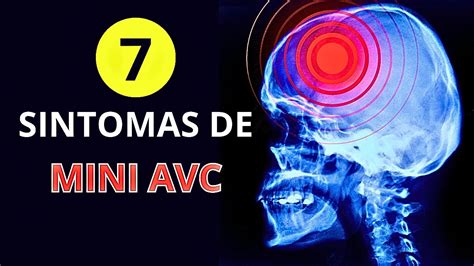 Descubra Agora 7 Sintomas De Mini AVC E Como Identificar Um Ataque