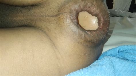 Anal Gaping Xhamster