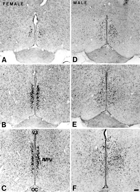 Sexually Dimorphic Expression Of Estrogen Receptor β In The Anteroventral Periventricular