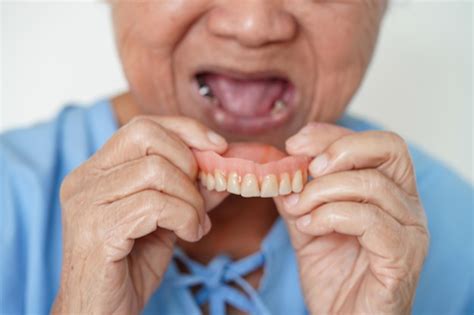 Paciente idosa asiática usando dentadura de dentes na boca para