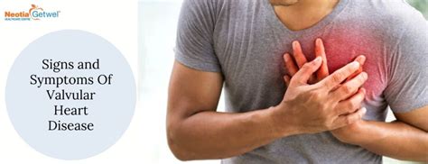 Identifying Heart Valve Disease Symptoms Your Guide To Early Detection