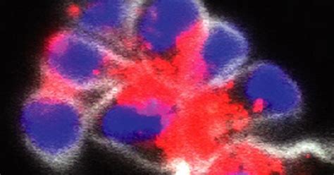 Newly Identified Aspect of Cell Death May Impact the Future of Fighting ... 