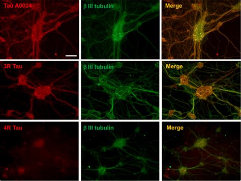 Distribution And Localization Of Tau In Primary Culture Of Rat ENS