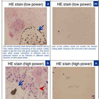 structure  cell block prepared  shidhams protocol