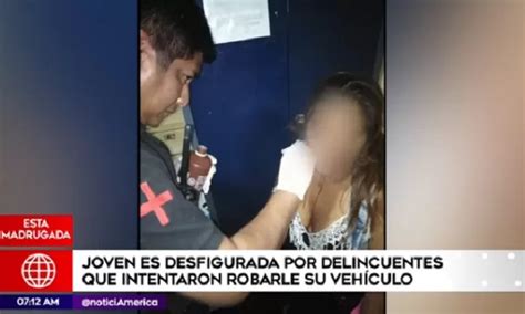 SJM Joven Es Desfigurada Por Delincuentes Que Intentaron Robarle El