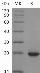 Human Shh C His Protein Neweast Biosciences Gtpase Oncogene And