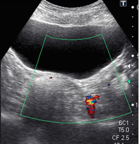 Pin on Renal Ultrasound Made Easy: Step-By-Step Guide