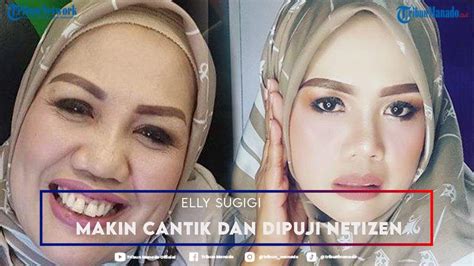 Potret Wajah Elly Sugigi Pasca Operasi Plastik Makin Cantik Dan Dipuji