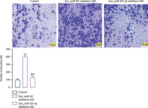 Bc Cell Derived Exosomes Induced Proliferation Invasion And Migration