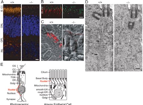 What Happens If Cone Cells Are Absent In Eye