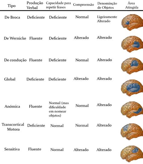 Afasiasabe O Que Ptmedical