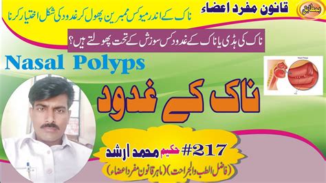 Nasal Polyps ناک کے غدود Qanoon Mufrad Aza Hakeem Muhammad Arshad