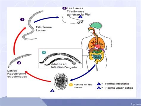 Uncinariasis