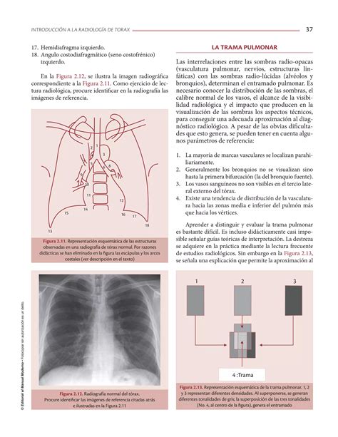 Fundamentos De Fisioterapia Respiratoria Y Ventilaci N Mec Nica Pdf