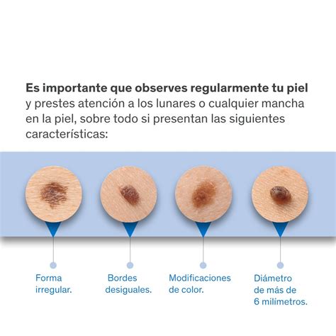 Centro Médico ABC on Twitter El melanoma es un tipo de cáncer de piel