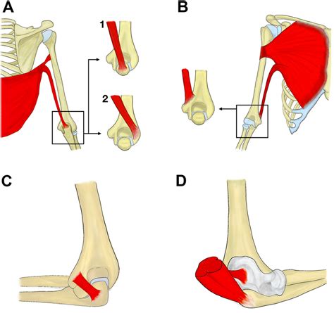 Origins And Insertions Of Four Described Variable Muscles Around The