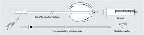 Bakri® Postpartum Balloon With Rapid Instillation Cascade Health Care