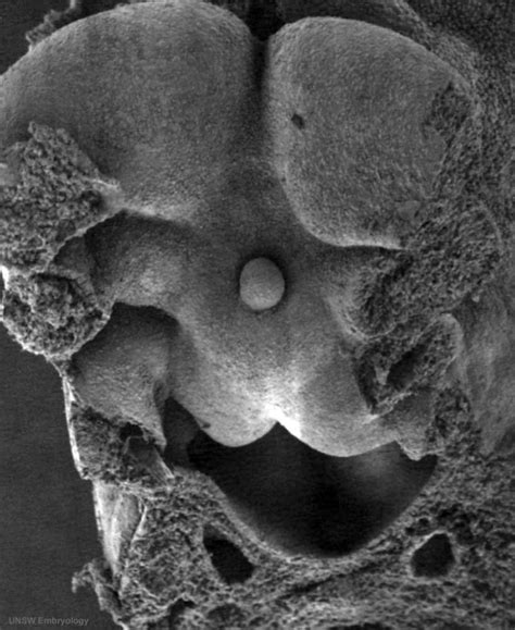 Tongue Development - Embryology