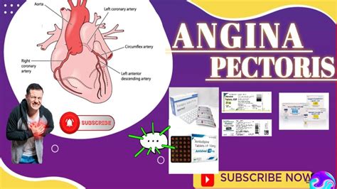 Angina Pectoris Anti Anginal Drugs Cardio Cardiology Medical