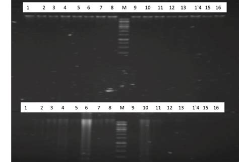 Electrophoretic Analysis Of Genomic DNA From Blood And Buccal Cell