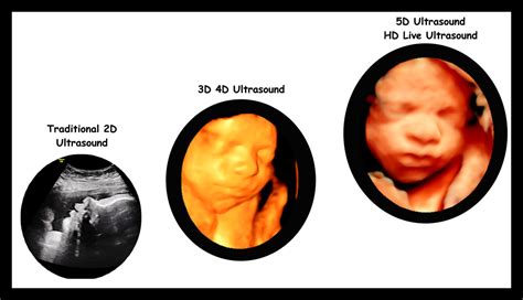 Differences In Imaging Between D D And D Ultrasound Off